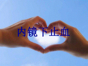 内镜下止血.ppt