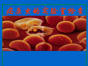 疟原虫的实验诊断与防治.ppt