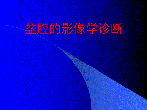8盆腔的影像学诊断.ppt