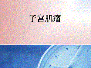子宫肌瘤健康教育.ppt