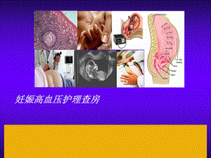 妊娠高血压护理查房新...ppt
