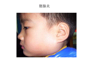 传染病症状图片.ppt