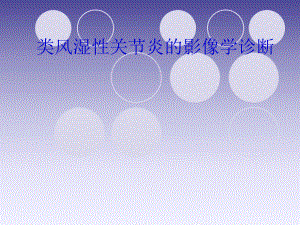 类风湿性关节炎的影像学诊断.ppt