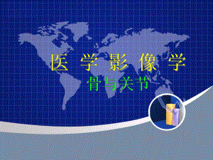 研究生医学影像学骨肿瘤.ppt