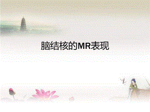 脑结核的影像学表现PPT.ppt