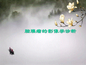 脑膜瘤的影像学诊断张经妮.ppt