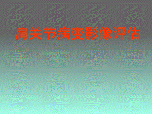 肩关节损伤影像学评估.ppt