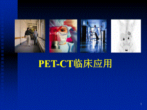 脑部PET的临床应用.ppt