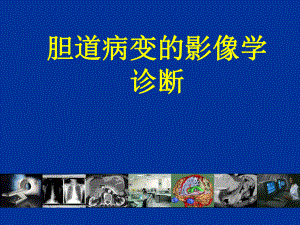 胆道疾病的影像学诊断素材.ppt