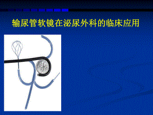 输尿管软镜的临床应用.ppt