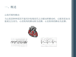 除颤仪的原理及质量控制.ppt
