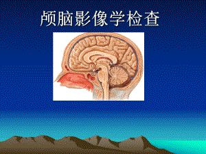 颅脑影像学检查.ppt