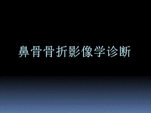 鼻骨骨折影像学诊断与鉴别(精品).ppt