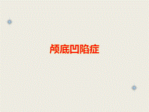 颅底凹陷症影像学诊断.ppt