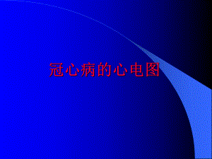 冠心病心电图.ppt
