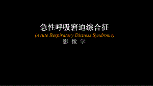急性呼吸窘迫综合征(ARDS)的影像学表现.ppt