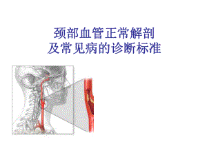 颈部血管超声正常解剖及常见病的超声诊断标准.ppt
