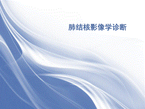 肺结核的影像学诊断.ppt