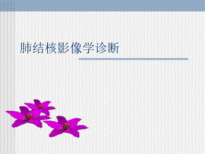 肺结核的影像学诊断.ppt