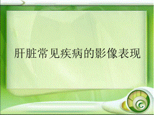 肝脏常见疾病的影像学表现.ppt