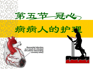 冠心病病人护理.ppt