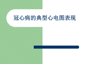冠心病的典型心电图表现.ppt
