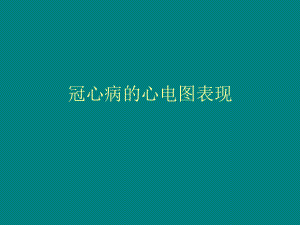 冠心病的心电图表现#.ppt