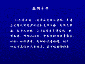 传染病学麻疹.ppt