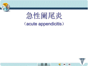 急性阑尾炎精品医学PPT课件.ppt