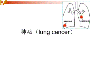 肺癌医学PPT课件.ppt