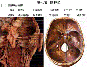 脑神经(解剖生理学).ppt
