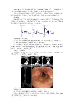 59岁女性患哮喘14年最近症状不能控制真实原因并不简单（附哮喘可以控制但不能根治）.docx