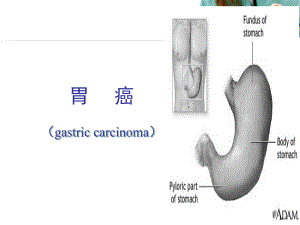 胃癌教学课件幻灯片课件.ppt