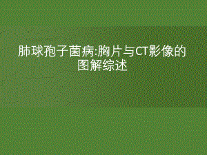 肺球孢子菌病影像学表现.pptx