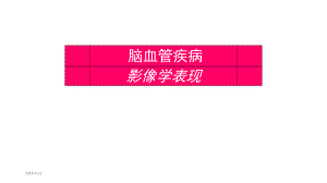 脑血管疾病影像学表现.pptx