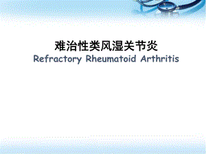 难治性类风湿关节炎医学PPT课件.ppt