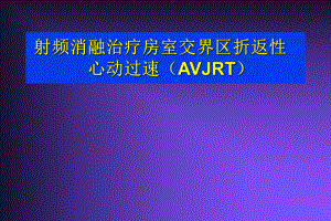 射频治疗室上速性心律失常名师编辑PPT课件.ppt