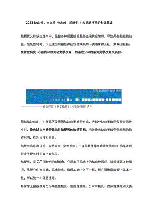 2023缺血性、出血性、分水岭、腔隙性4大类脑梗死的影像解读.docx