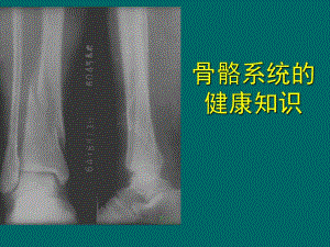 骨骼系统健康知识J.ppt