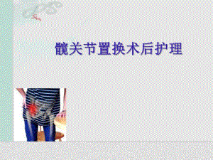 髋关节置换术后护理.ppt
