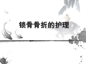 锁骨骨折的护理课件.ppt