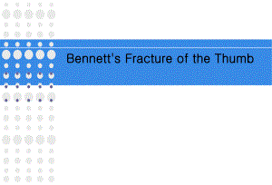 陈旧性bennett骨折的处理.ppt