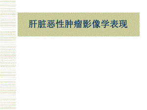 肝脏恶性肿瘤影像学表现.ppt