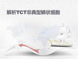 能够用TCT检查有非典型鳞状细胞吗.ppt