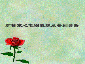 肺栓塞心电图.ppt