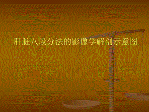 肝脏八段分法的影像学解剖示意图.ppt