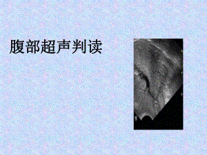 腹部超声判读.ppt