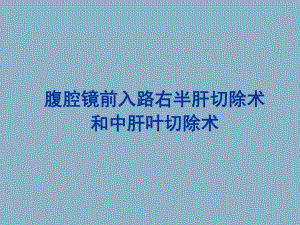 腹腔镜前入路右半肝切除术和中肝叶切除术.ppt