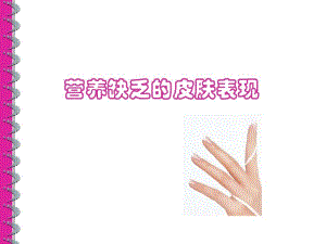 营养缺乏的皮肤表现090804.ppt