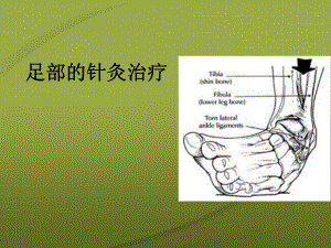 足痛的针灸治疗.ppt